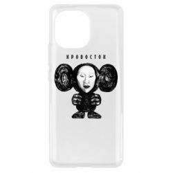 Чехол для Xiaomi Mi11 Альбом Чебурашка - PrintSalon