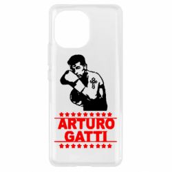 Чехол для Xiaomi Mi11 Arturo Gatti - PrintSalon