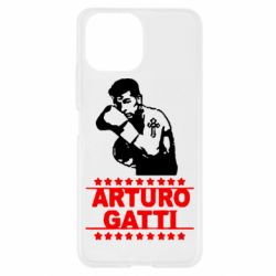 Чехол для Xiaomi Mi11 Lite Arturo Gatti - PrintSalon
