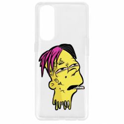 Чехол для Oppo Reno 4 Pro Bart as Lil Peep - PrintSalon