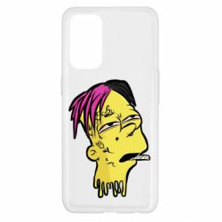 Чехол для Oppo Reno 5 4G Bart as Lil Peep - PrintSalon