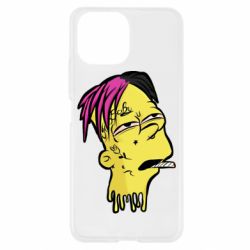 Чехол для Xiaomi Mi11 Lite Bart as Lil Peep - PrintSalon