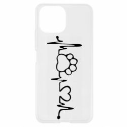 Чехол для Xiaomi Mi11 Lite Cardio - PrintSalon