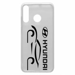 Чехол для Huawei P30 Lite Хендай - PrintSalon