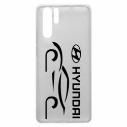 Чехол для Huawei P30 Pro Хендай - PrintSalon