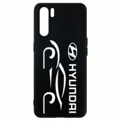 Чехол для Oppo A91/Reno3 Хендай - PrintSalon