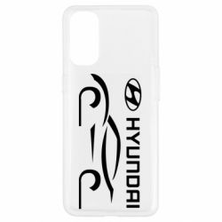 Чехол для Oppo Reno 4 Хендай - PrintSalon