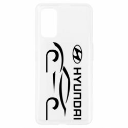 Чехол для Realme 7 Pro Хендай - PrintSalon