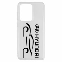 Чехол для Samsung S20 Ultra Хендай - PrintSalon