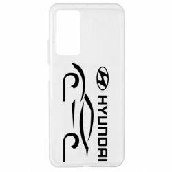 Чехол для Xiaomi Mi 10T/10T Pro Хендай - PrintSalon