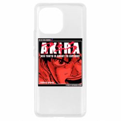 Чохол для Xiaomi Mi11 Akira