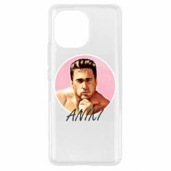 Чехол для Xiaomi Mi11 ANIKI - PrintSalon