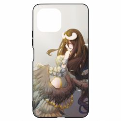 Чехол для Xiaomi Mi11 Lite Albedo - PrintSalon