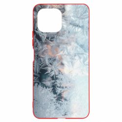 Чохол для Xiaomi Mi11 Lite Frosting pattern - PrintSalon