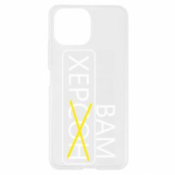 Чохол для Xiaomi Mi11 Lite Херсон вам - PrintSalon