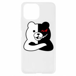 Чохол для Xiaomi Mi11 Lite Monomishka with hands - PrintSalon