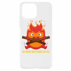 Чехол для Xiaomi Mi11 Lite MY HEART ONLY  BURNS FOR YOU - PrintSalon