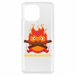 Чехол для Xiaomi Mi11 MY HEART ONLY  BURNS FOR YOU - PrintSalon