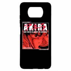 Чохол для Xiaomi Poco X3 Akira