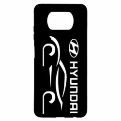 Чехол для Xiaomi Poco X3 Хендай - PrintSalon