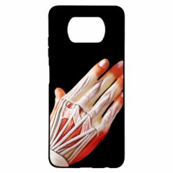 Чохол для Xiaomi Poco X3 Muscle suit - PrintSalon