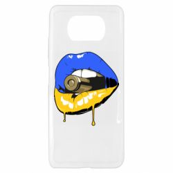 Чохол для Xiaomi Poco X3 - PrintSalon