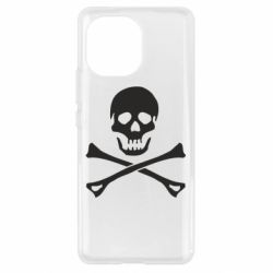 Чехол для Xiaomi Mi11 Череп и кости - PrintSalon