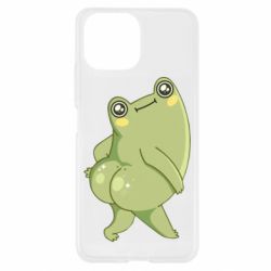 Чехол для Xiaomi Mi11 Lite Froggylicious - PrintSalon