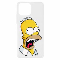 Чехол для Xiaomi Mi11 Lite Crazy Homer! - PrintSalon