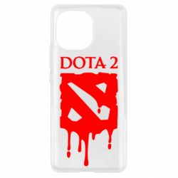 Чехол для Xiaomi Mi11 Dota 2 Logo - PrintSalon