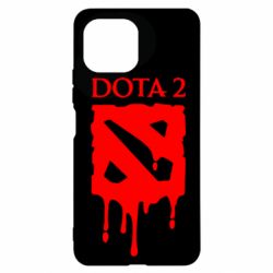 Чехол для Xiaomi Mi11 Lite Dota 2 Logo - PrintSalon