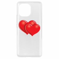 Чехол для Xiaomi Mi11 Два сердца - PrintSalon