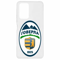 Чехол для Xiaomi Redmi Note 10 Pro ФК Говерла Ужгород - PrintSalon
