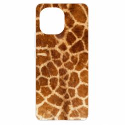 Чехол для Xiaomi Mi11 Giraffe's Skin - PrintSalon