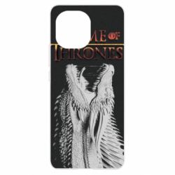 Чехол для Xiaomi Mi11 Gray dragon - PrintSalon