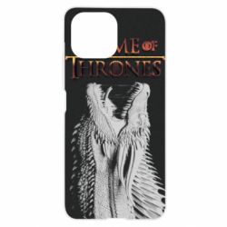 Чехол для Xiaomi Mi11 Lite Gray dragon - PrintSalon