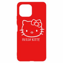 Чехол для Xiaomi Mi11 Lite Hello Kitty - PrintSalon