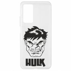 Чохол для Xiaomi Mi 10T / 10T Pro Hulk face - PrintSalon