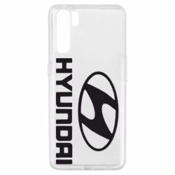 Чехол для Oppo A91/Reno3 Hyundai Small - PrintSalon