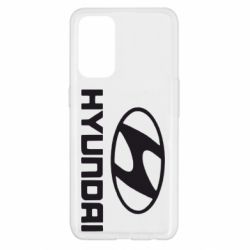 Чехол для Oppo Reno 5 4G Hyundai Small - PrintSalon