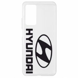 Чехол для Xiaomi Mi 10T/10T Pro Hyundai Small - PrintSalon