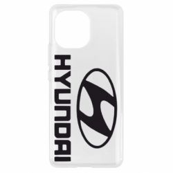 Чехол для Xiaomi Mi11 Hyundai Small - PrintSalon