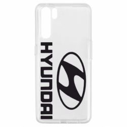 Чехол для Oppo A91/Reno3 HYUNDAI - PrintSalon