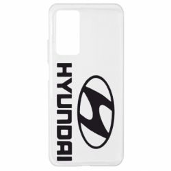 Чехол для Xiaomi Mi 10T/10T Pro HYUNDAI - PrintSalon