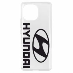 Чехол для Xiaomi Mi11 HYUNDAI - PrintSalon