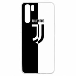 Чехол для Oppo A91/Reno3 Juventus black and white logo - PrintSalon