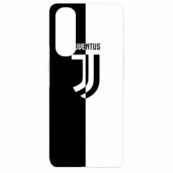 Чехол для Oppo Reno 4 Pro Juventus black and white logo - PrintSalon