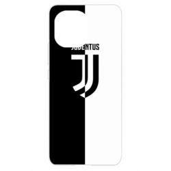 Чехол для Xiaomi Mi11 Juventus black and white logo