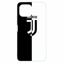 Чехол для Xiaomi Mi11 Lite Juventus black and white logo - PrintSalon