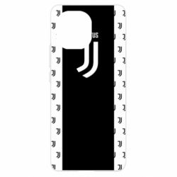 Чехол для Xiaomi Mi11 Juventus pattern